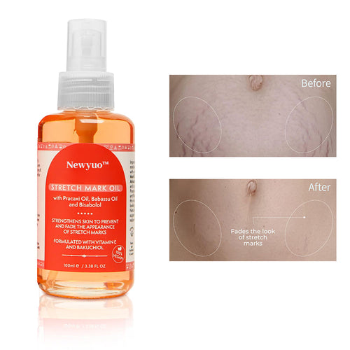 Newyuo™ Skin Care Oil for Stretch Marks, Scars, Vegan & Paraben Free