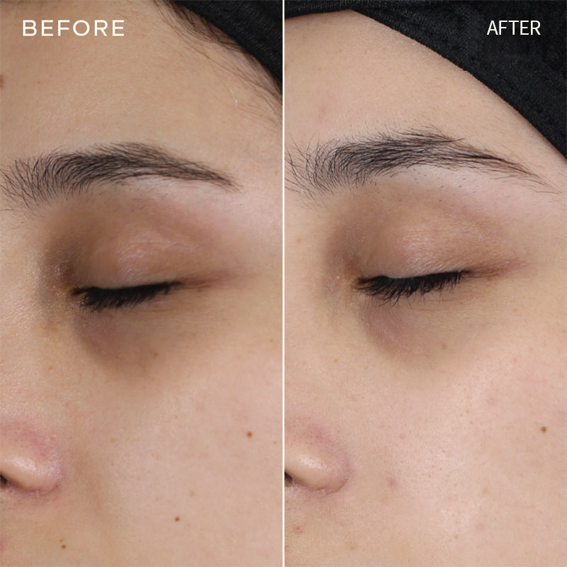 Newyuo™ Eye Serum with Caffeine & Retinol Hyaluronic Acid for Puffy Eye Bags, Fine Lines & Dark Circles