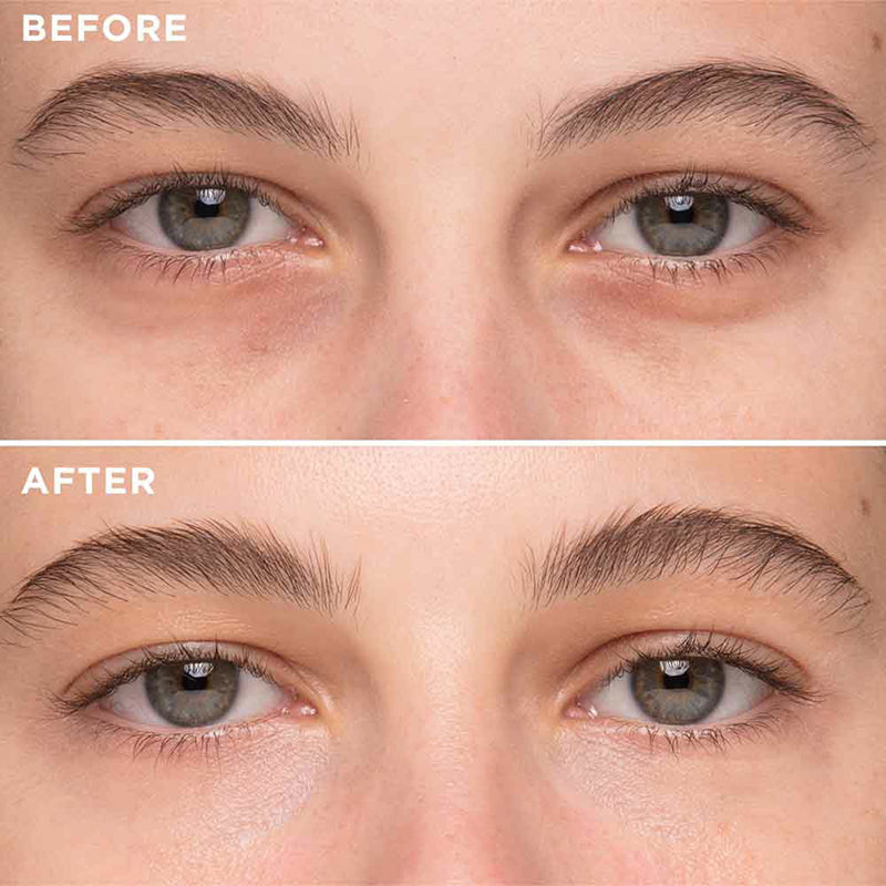Newyuo™ De-Puffing Eye Roller, Eye Serum for Puffiness, Fine lines & Dark Circles