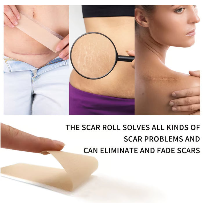 🎁BUY 1 GET 1 FREE 💥 Silicone gel scar patch