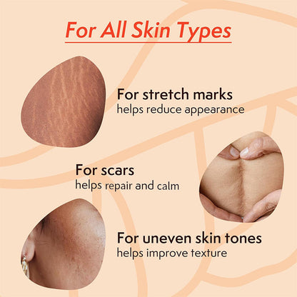 Newyuo™ Skin Care Oil for Stretch Marks, Scars, Vegan & Paraben Free