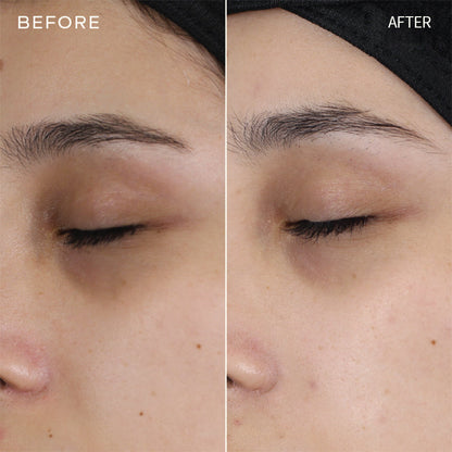 Newyuo™ Eye Serum with Caffeine & Retinol Hyaluronic Acid for Puffy Eye Bags, Fine Lines & Dark Circles