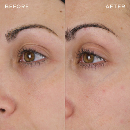 Newyuo™ Eye Serum with Caffeine & Retinol Hyaluronic Acid for Puffy Eye Bags, Fine Lines & Dark Circles
